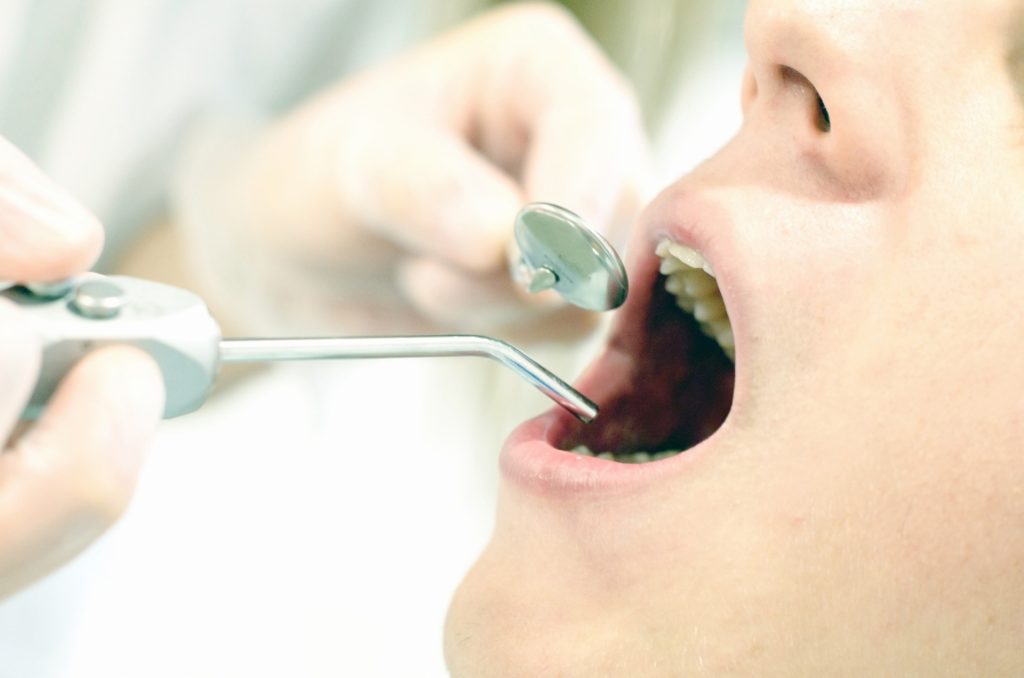 子どもの虫歯はひどくなる前に…歯医者選びがマジで重要な理由！